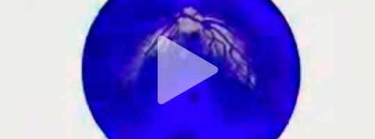 Marialuisa Tadei - Video Kisses from Genesis